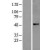 Western Blot: ABHD8 Lysate [NBL1-07202] - Western Blot experiments. 
Left-Control; Right -Over-expression Lysate for ABHD8